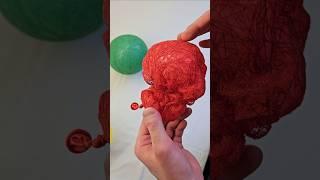 The balloon compresses the threads