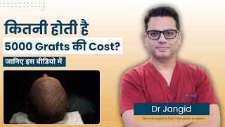 How Much Does 5000 Hair Grafts Cost? | Find Out from a Hair Transplant Surgeon | Dr Jangid