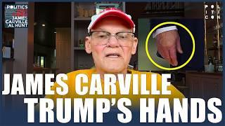 James Carville: What Is Wrong With Trump's Hands