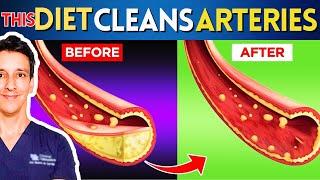 Best Diet to UNCLOG Arteries