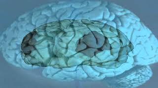 Northern Conspiracy - All Worms, No Brain + Brain Worms