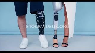 amputee couple man & woman with prosthet...