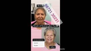 #skincare #glassskin #koreanskincare #atomy
