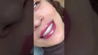 Композитные виниры с прозрачным режущим краем. Dr.Gussoeva