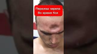 Боец ММА получил перелом черепа во время боя #мма #попмма #боец #бой