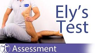 Ely's Test⎟Rectus Femoris Contracture