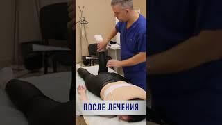 Почему может болеть шея.  метод PDTR