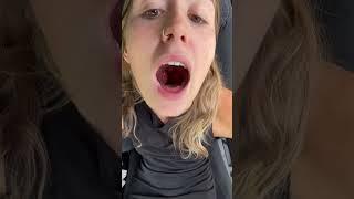 When are you coming to fix my throat? #ASMR #ZOERHODEASMR #ASMRGIRL #OF #ASMR #ZOERHODEASMR #AS