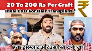 Cost of Hair Transplant in India | Hair Transplant Mai kitna Kharcha hota hai