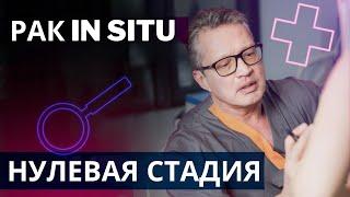 Рак in situ или нулевая стадия рака | Особенности диагноза и лечения