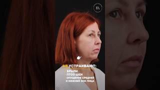 Большой омолаживающий комплекс Ранний результат! Пластический хирург ФИЛИППОВ АЛЕКСАНДР ИГОРЕВИЧ