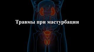 Травмы при мастурбации