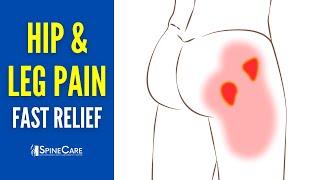 How to INSTANTLY Relieve Hip and Leg Pain