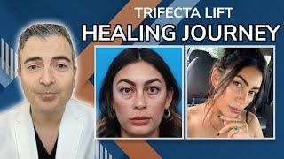 Healing After Trifecta Lift With Dr. Kami Parsa