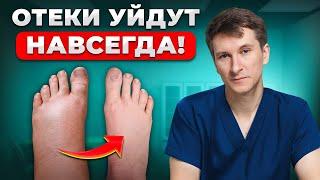 Как БЫСТРО избавиться от отеков? Настоящие причины застоя лимфы...