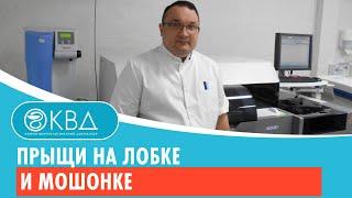  Прыщи на лобке и мошонке. Клинический случай №553