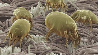 Good Question: What Are Dust Mites?