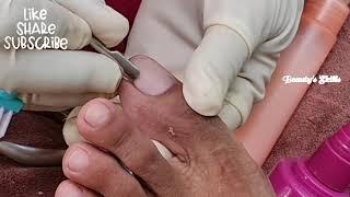 Step by step cuticle removal| without ingrown(Part2) | Beauty's Skills