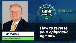 Thomas Weldon | How to Reverse Your Epigenetic Age Now