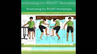 stroke #paralysis #hemiplegia ##exercise #rehabilitation #physiotherapy