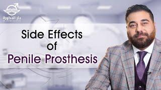 The Penile Prosthesis Surgery - Side Effects | Dr Osama Ghattas