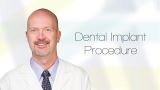 Dental Implant Procedure Info in Odessa TX | Permian Basin Oral Surgery & Dental Implant Center