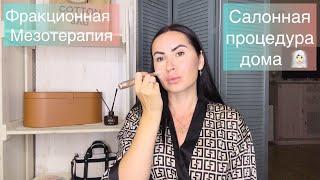 ‍️Больше не хожу к косметологу - делаю ДОМА САМА Фракционная мезотерапия