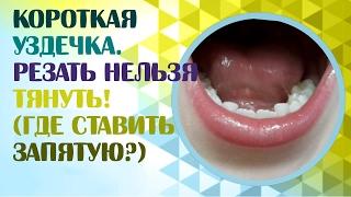 Короткая уздечка языка или короткая подъязычная уздечка.Нужно ли подрезать короткую уздечку?