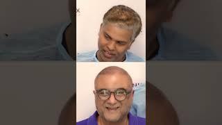 Bollywood Film Producer  Boney Kapoor trusts Eugenix for his Hair Transformation #bollywoodproducer