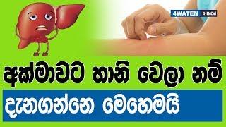 අක්මාවට හානි වෙලා නම් දැනගන්නෙ මෙහෙමයි : How to know your liver is damaging (NEW) 2019