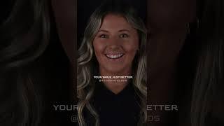 Smile makeover before and after