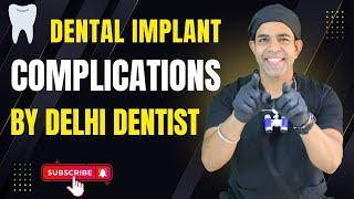 Dental Implant EXPERTS Share Top Tips to Avoid Complications