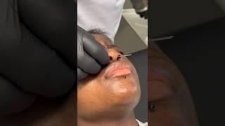 Septum piercing ~ Montreal piercing studio Paradise #montreal #montrealcity #piercing #tattoostudio