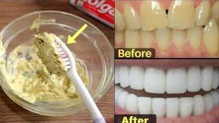 Get white teeth in just 2 minutes / How to whiten teeth in 2 minutes.