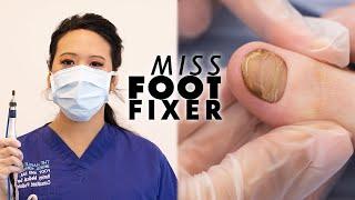 Ripping Out Toenails Is My Dream Job | MISS FOOT FIXER