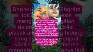 cerita kehidupan #fyp #berita #beritaviral #oplas  #jangkauanluas