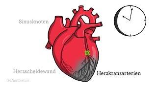 Was passiert bei einem Herzinfarkt?
