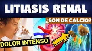 TODO SOBRE LITIASIS RENAL (Síntomas, Diagnostico y Tratamiento)