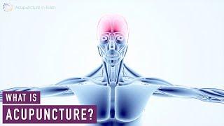 WHAT IS ACUPUNCTURE