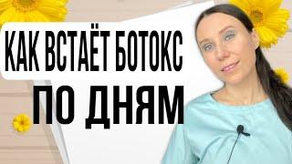 КАК ВСТАЁТ БОТОКС НА ЛБУ. Межбровье морщины. На какой день встаёт ботокс.