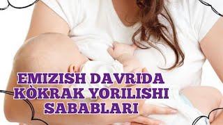 Emizish davrida kòkrak uchi yorilishi sabablari davolash va oldini olish choralari