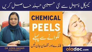 CHEMICAL PEELS KE FAYDE IN URDU - What Is Chemical Peel - How To Use It - Benefits Of Peeling Skin