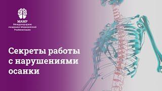 Прямой эфир: Формирование осанки: реабилитация и мифы. Вебинар для врачей от МАМР | МАМР