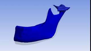 Temporomandibular Joint Ansys Analysis