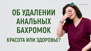 Удалять ли АНАЛЬНЫЕ БАХРОМКИ ради красоты ануса?