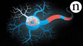 Inside ALS: The neurons behind the disease