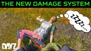 [OLD]The New DayZ Damage System | 1.12 Health & Shock Damage Changes