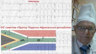 Chapter-7: Гострі та хронічні коронарні синдроми. Частина №2. #proECG