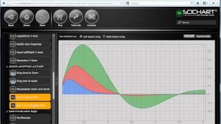 WPF Charts - SciChart Introduction - High Performance WPF Charting
