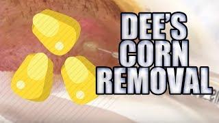 Dee's Corn Extraction Remix | Dr. John GIlmore